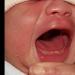 Vad man ska göra om ett spädbarn ofta nyser och hostar, men det är ingen temperatur Ett spädbarn hostar och nyser vad man ska göra