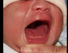 Vad man ska göra om ett spädbarn ofta nyser och hostar, men det är ingen temperatur Ett spädbarn hostar och nyser vad man ska göra