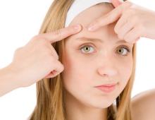 De bästa recepten för aknemasker för tonåringar Ansiktsmask för barn