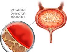 गर्भावस्था के दौरान मूत्र में बैक्टीरिया आने के कारण - भ्रूण पर प्रभाव और उपचार