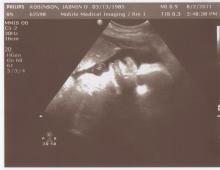 صورة الجنين وصورة البطن والموجات فوق الصوتية وفيديو عن نمو الطفل في الأسبوع 40