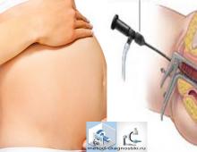 Graviditet efter hysteroskopi - planering för att bli gravid och eventuella problem